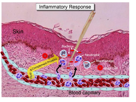 <p>Stinulus</p><p>mediators</p><p>vascular</p><p>cellular</p><p>repair/resolution</p>