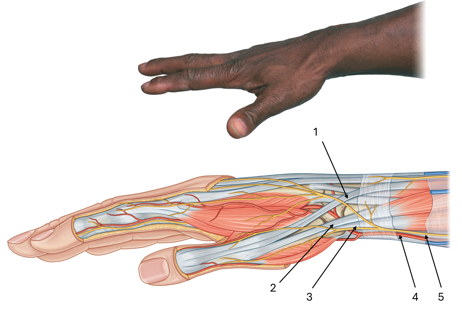<p>label this diagram of the anatomical snuffbox</p>