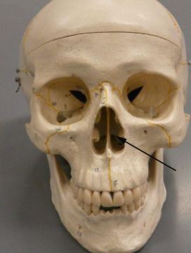 <p>Which cavity is this?</p>