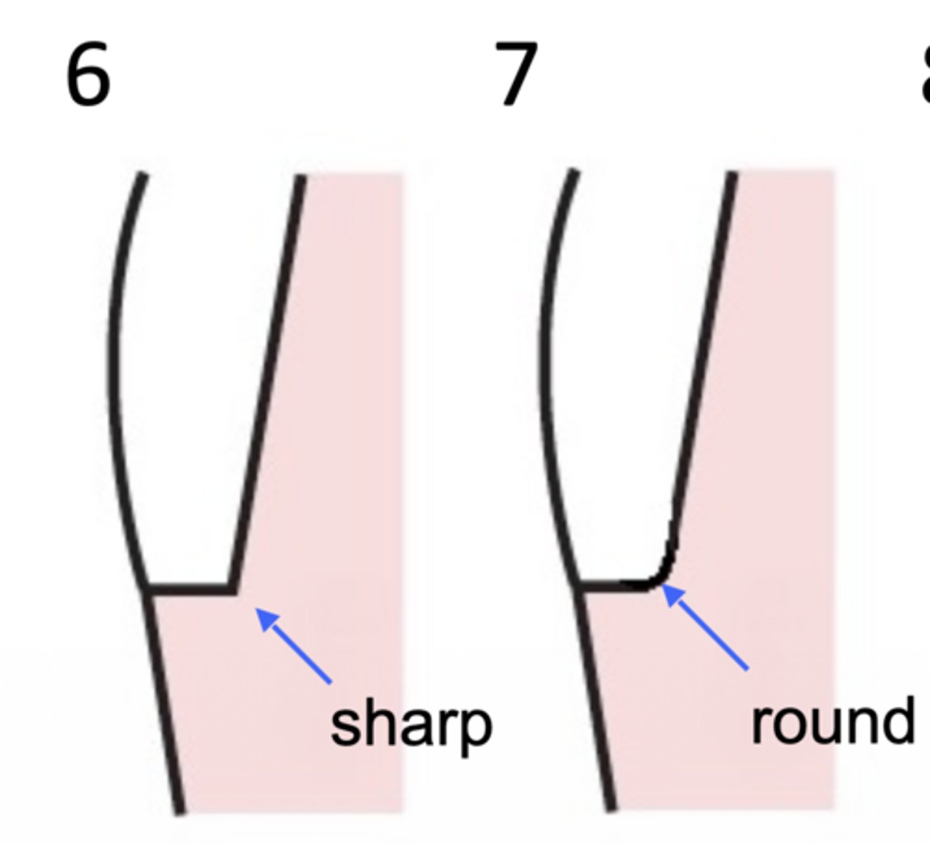 <p>What type of margin design is at 6?</p>