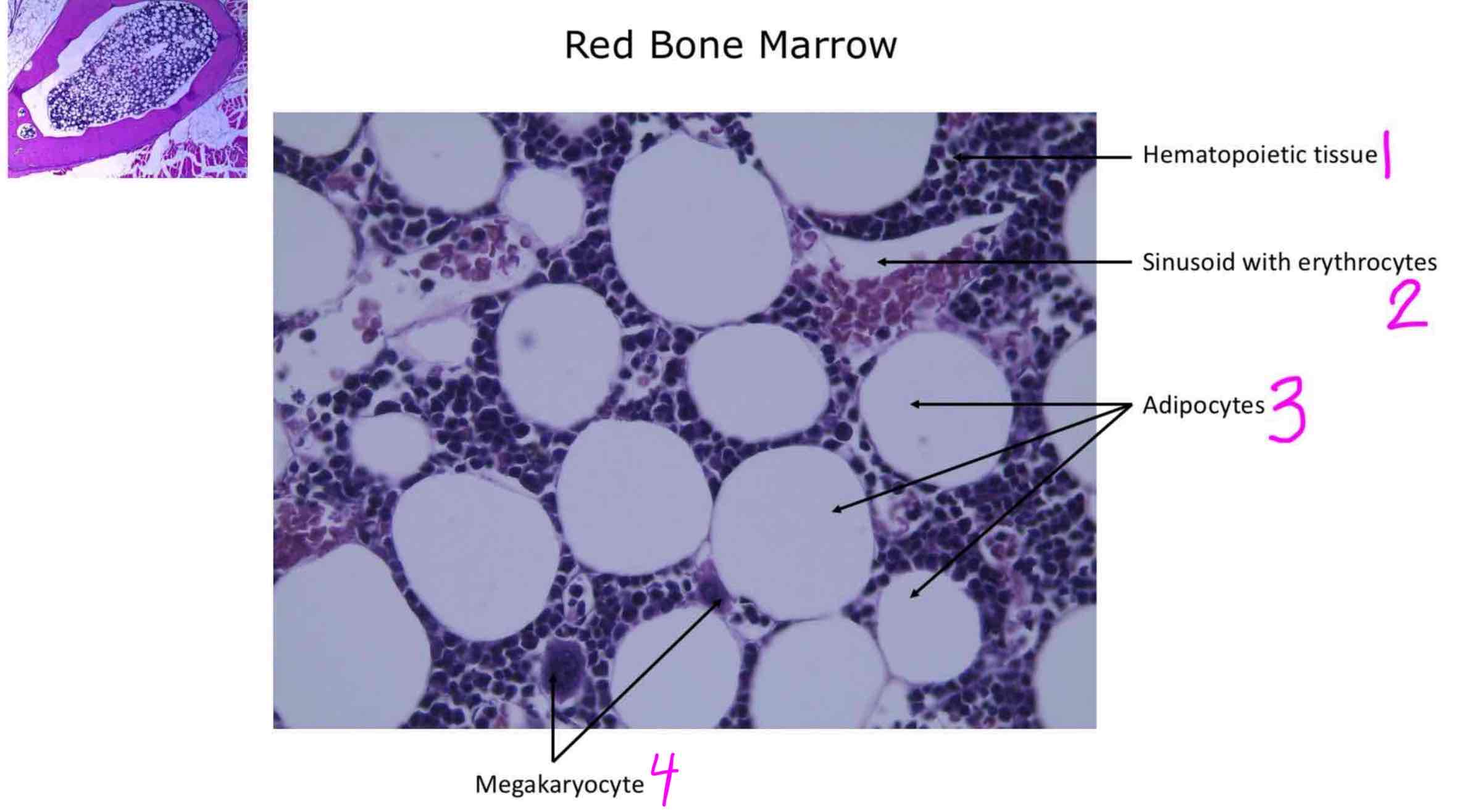 <ol><li><p>Hematopoietic tissue</p></li><li><p>Sinusoid with erythrocytes</p></li><li><p>Adipose</p></li><li><p>Megakaryocyte</p></li></ol>