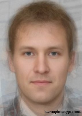 <p>Identify this Phenotype</p>