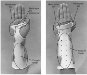 <p>Name this static splint component. What’s its function?</p>