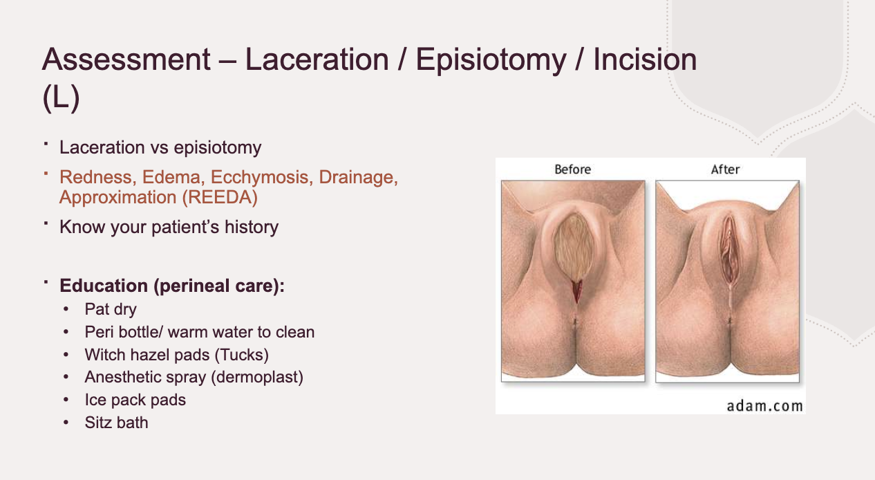 <ul><li><p><strong>What you do:</strong> Inspect perineum/incision using REEDA scale (Redness, Edema, Ecchymosis, Discharge, Approximation). Ask about pain.</p></li><li><p><strong>Expected:</strong> Some swelling and tenderness normal. Incision well-approximated, no discharge. Hemorrhoids may be present but not severe.</p></li><li><p><strong>Abnormal:</strong> Severe pain, hematoma (bulging, blue, very tender), infection (redness, pus, separation), uncontrolled bleeding.</p></li></ul><p></p>