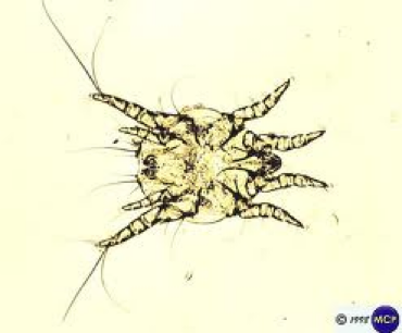 <p>what kind of mite</p>