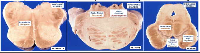 <ul><li><p>Based on cytological characteristics (shape &amp; size) of neurons — 3 regions </p><ul><li><p>Median region (raphe component) —</p><ul><li><p>Contains raphe nuclei &amp; a region where fibers exchange between sides</p></li></ul></li><li><p>Medial/paramedian region —</p></li><li><p>Lateral region —</p><ul><li><p>Extends in the cervical segment of the spinal cord</p></li></ul></li></ul></li><li><p>Basically if we go from midline of brainstem (medial → lateral) we find 3 subdivisions with cells differing in size &amp; shape</p></li></ul><p></p>