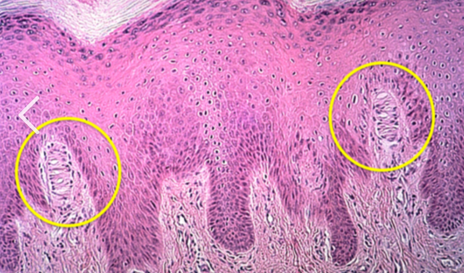 <p>the yellow circles are around</p>