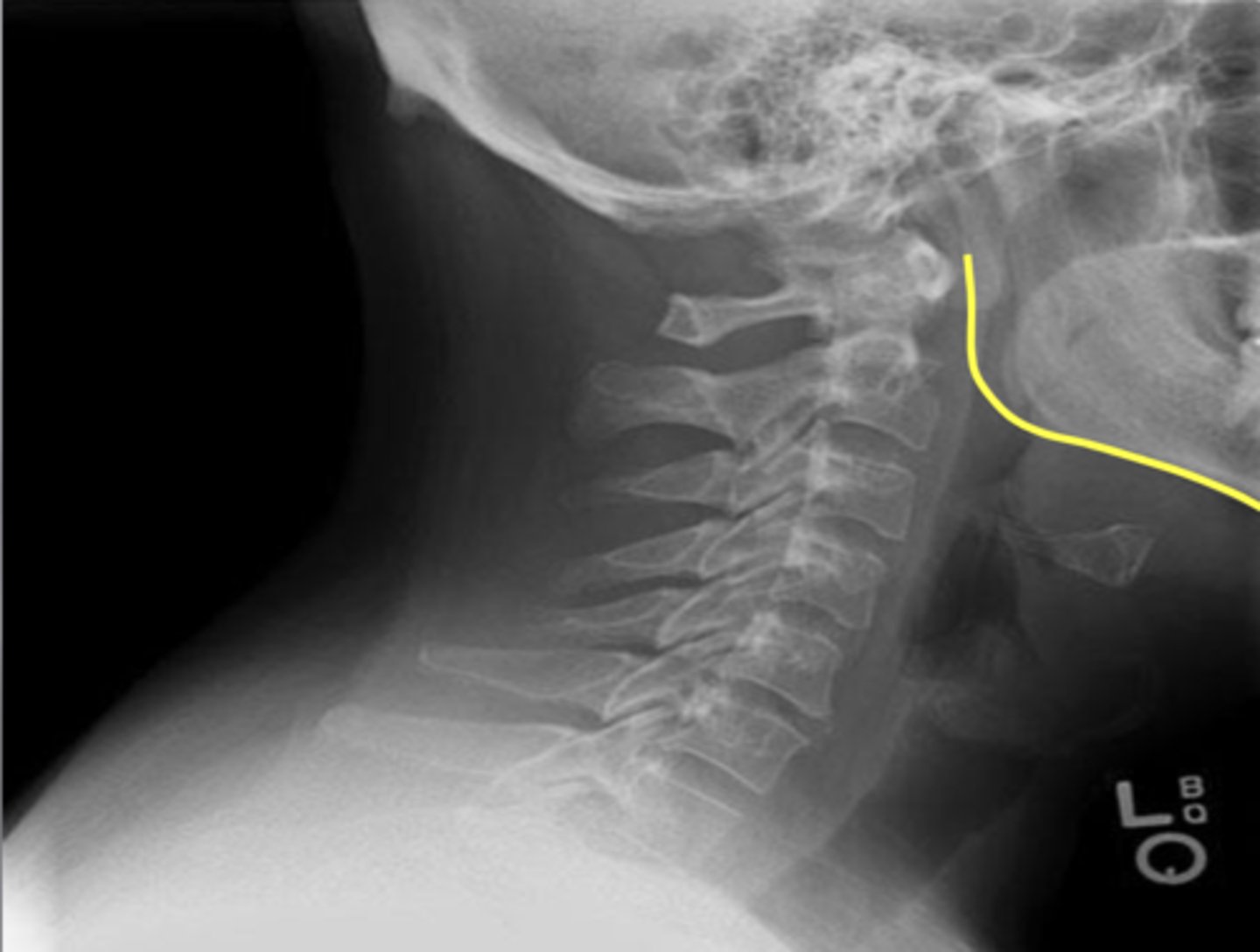 <p>What is outlined in yellow?</p>