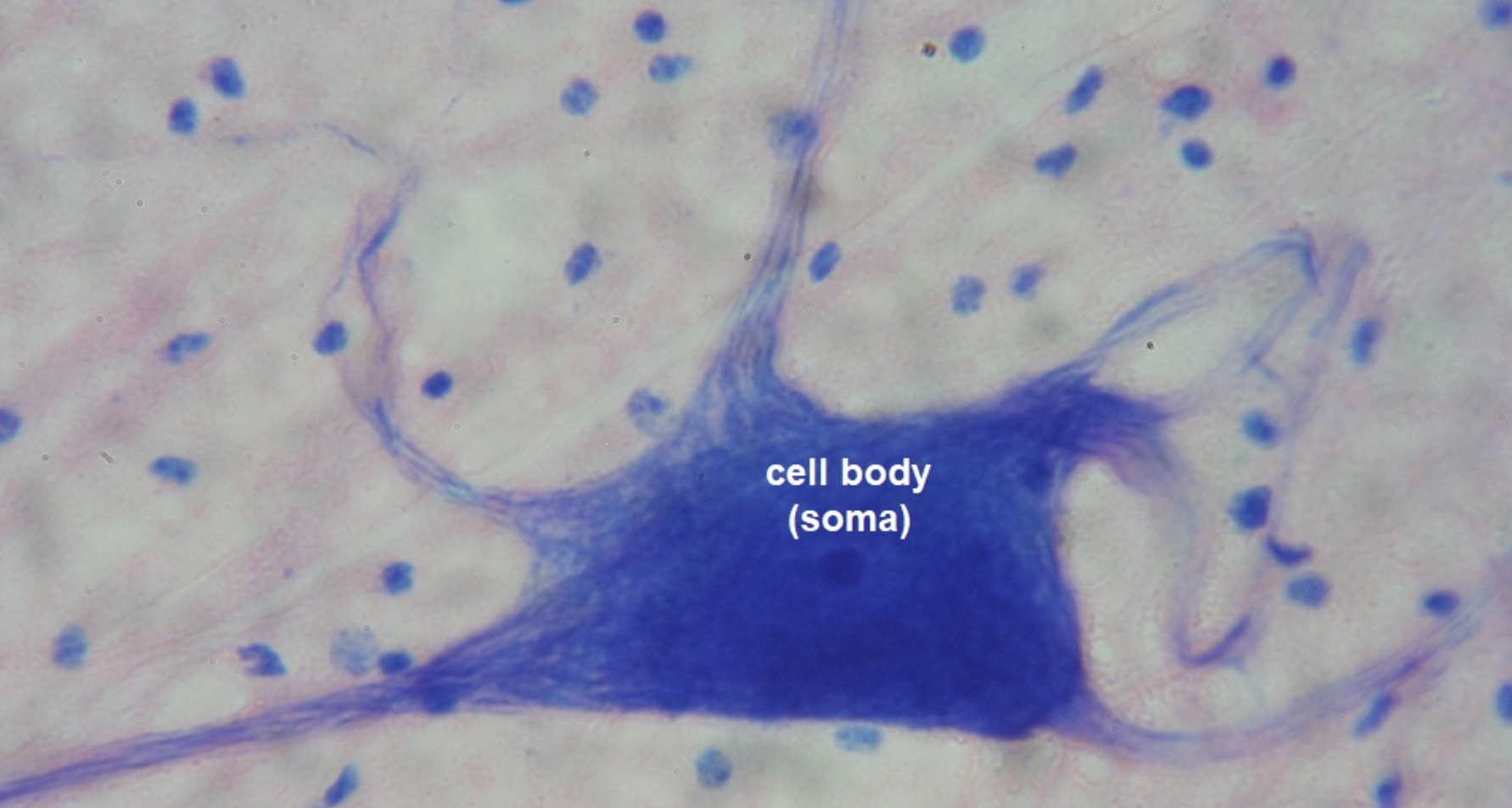 There are three or more ends that come from the cell body