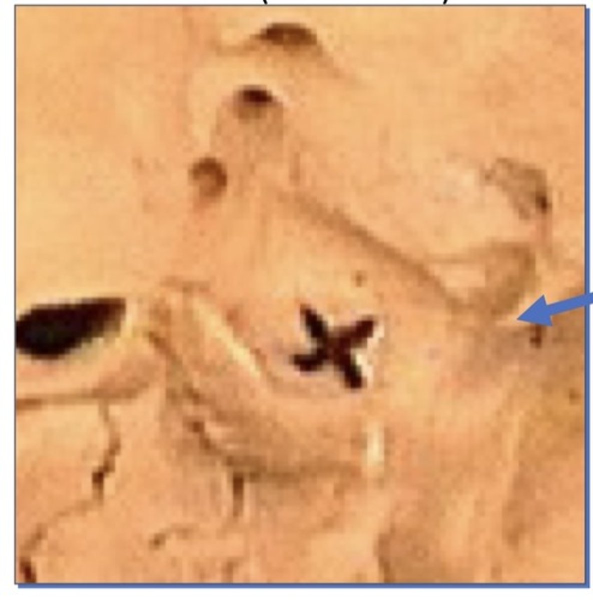 <p>1. Edge of sella turcica</p>