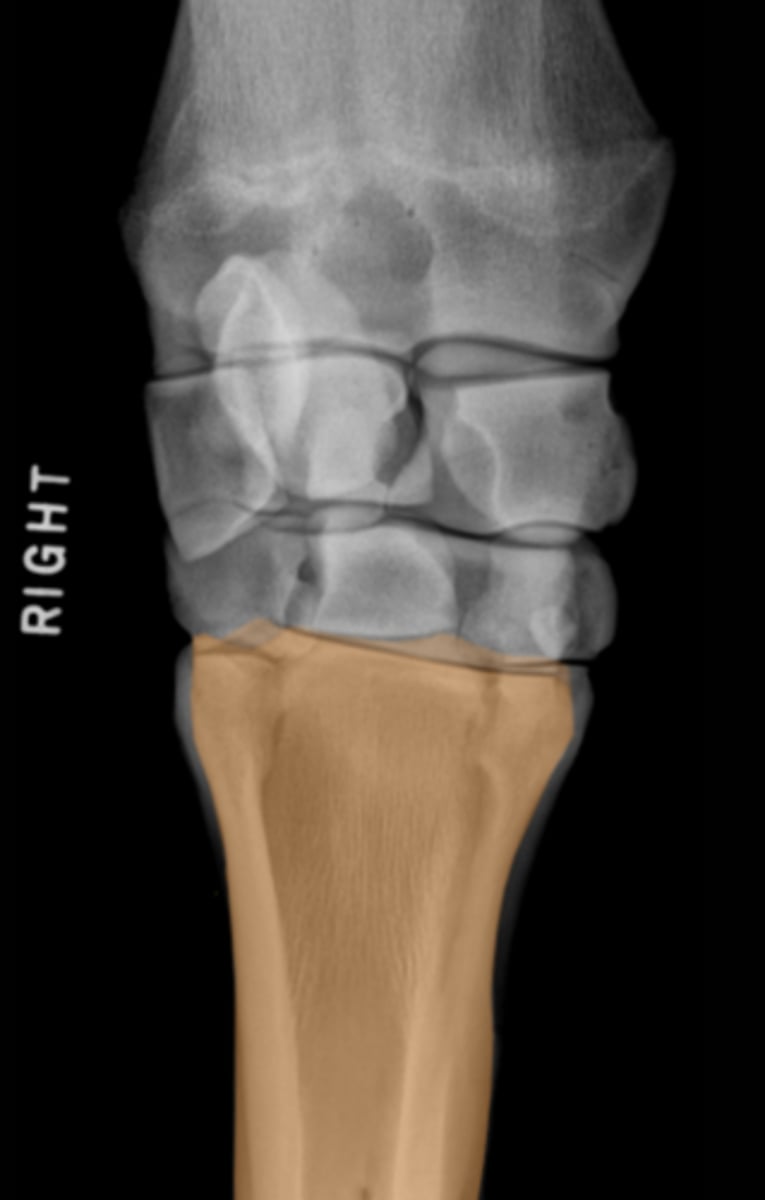 <p>What bone is highlighted?</p>