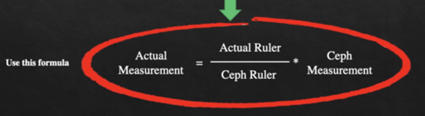 <p>Actual measurement=</p><p>(actual ruler/ceph ruler) X ceph measurement</p>