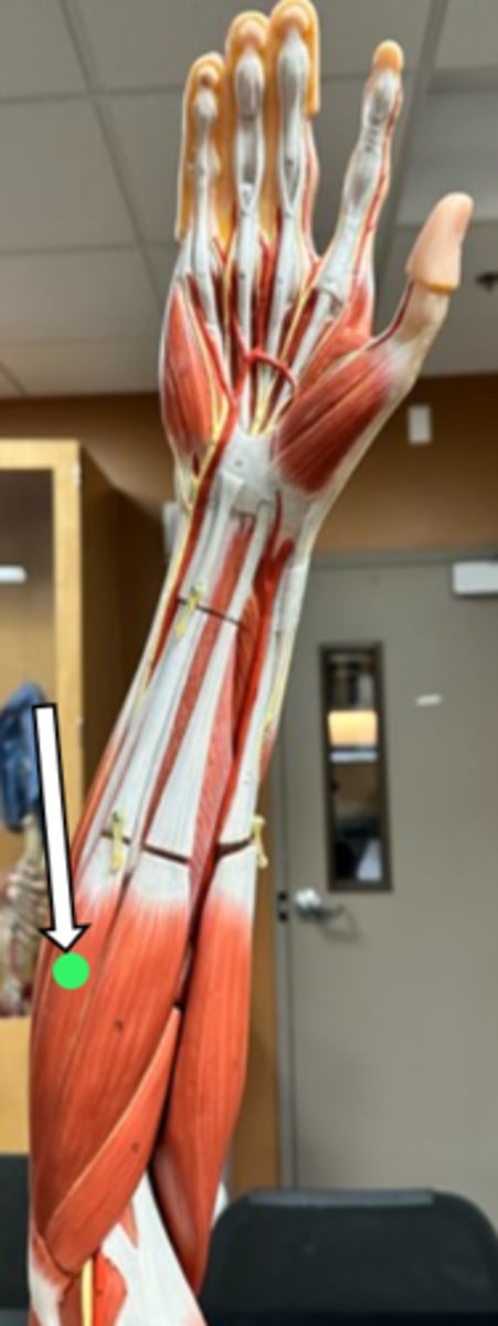<p>palmaris longus (function)</p>