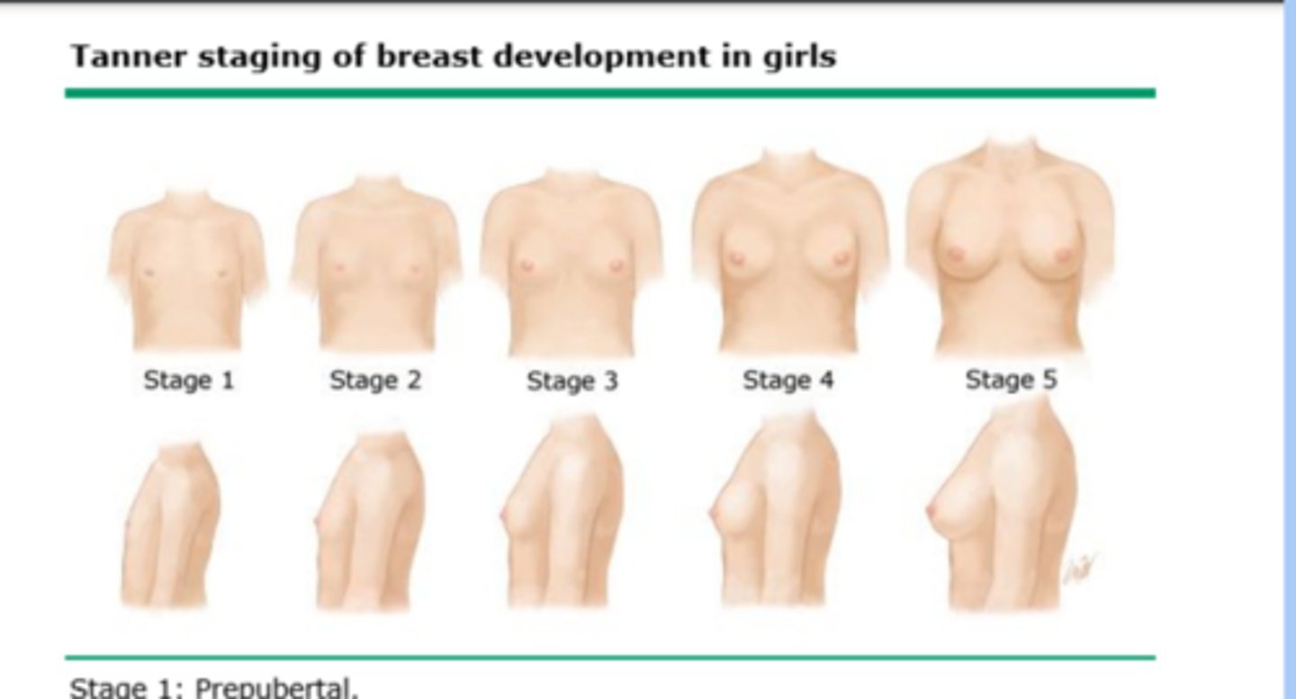 <p>-stage 1: no development</p><p>-stage 2: breast bud</p><p>-stage 3: further enlargement</p><p>-stage 4: projection of areola and papilla</p><p>-stage 5: mature stage</p>