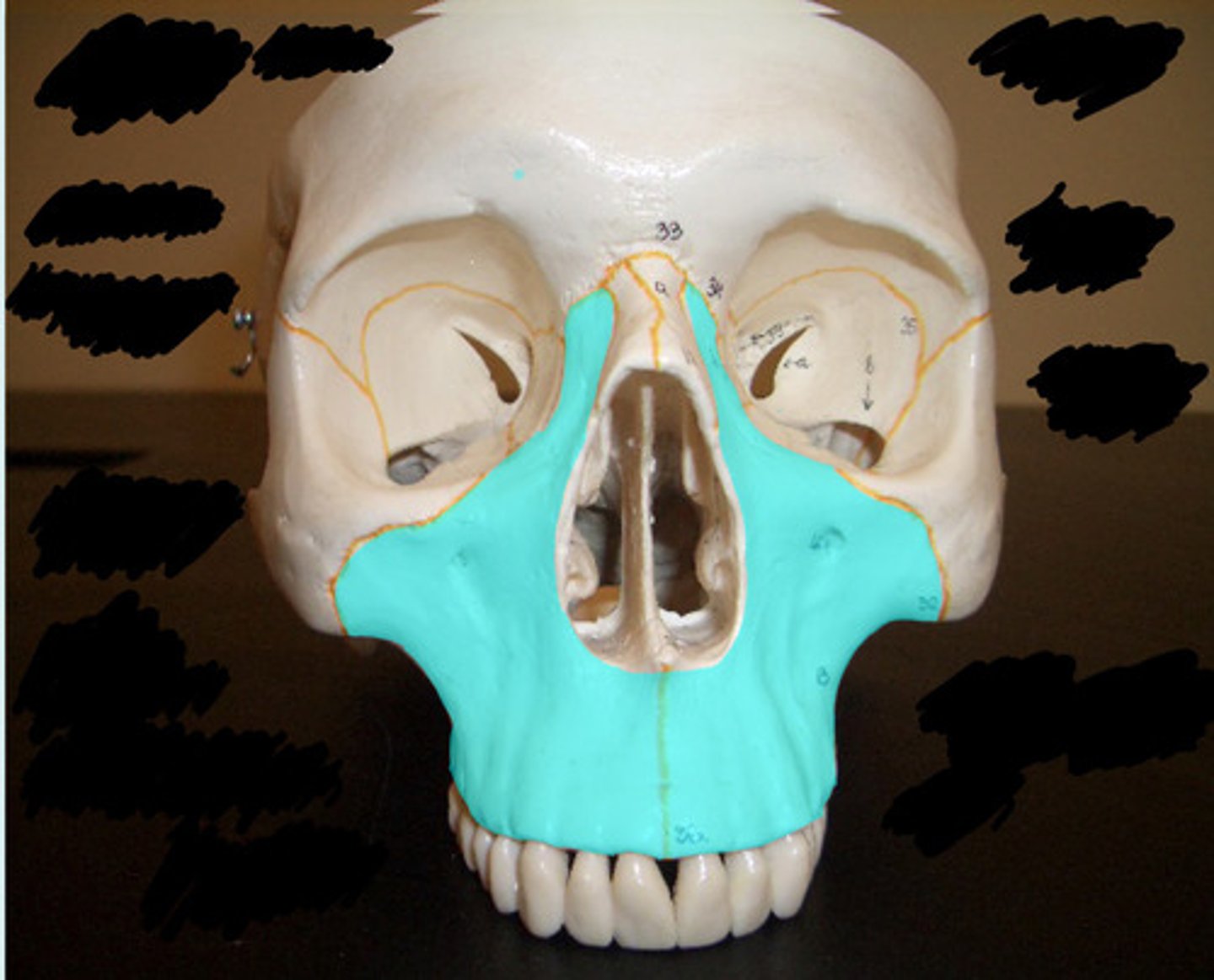 <p>What bone is highlighted here?</p>