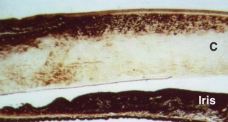 Albumin staining shows the non-uniform nature of cornea