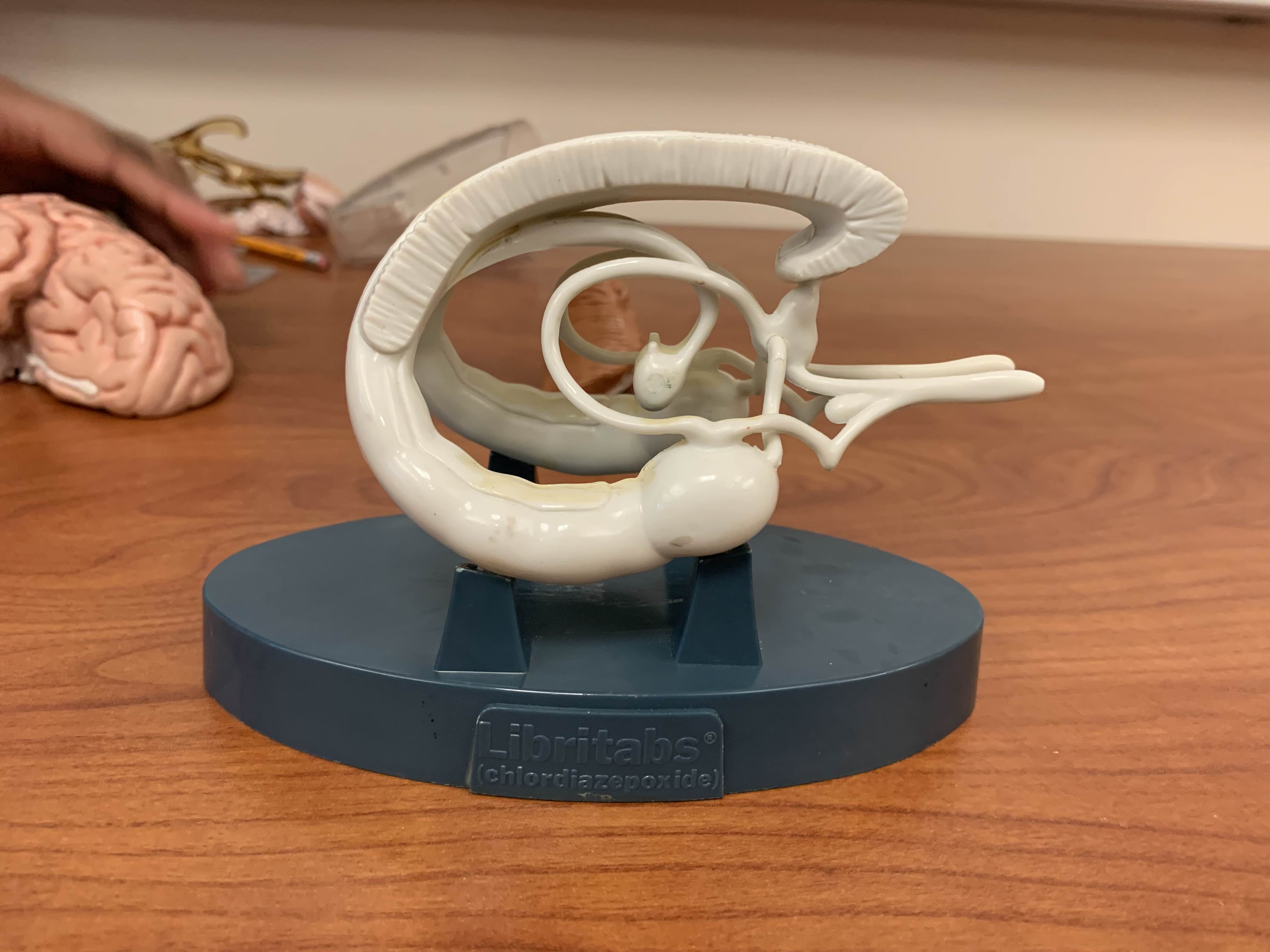 <p>What structure of the brain is this model?</p>