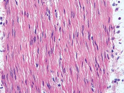 <p><span style="font-family: Calibri">Hartspierweefsel (regeneratief en kern)</span></p>