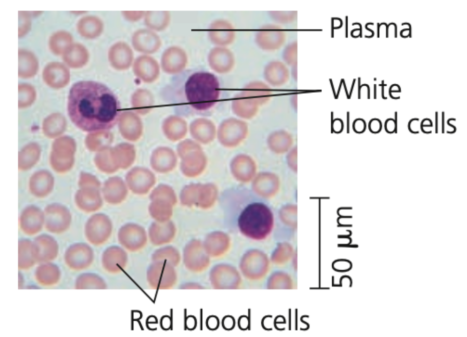 Blood
➔ Has a liquid extracellular matrix called ______ (water, salts, & dissolved proteins)
➔ Suspended in plasma are
◆ _______ (RBCs) - carry oxygen
◆ ________ (WBCs) - defense
◆ cell fragments (_____) - in blood clotting