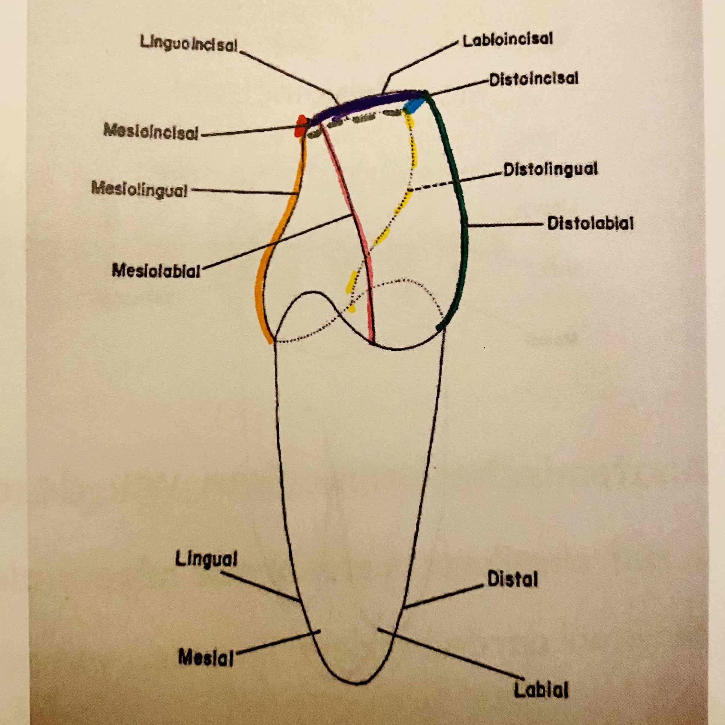 <p>Benoem de hoeklijnen van de anterieure tand.</p>