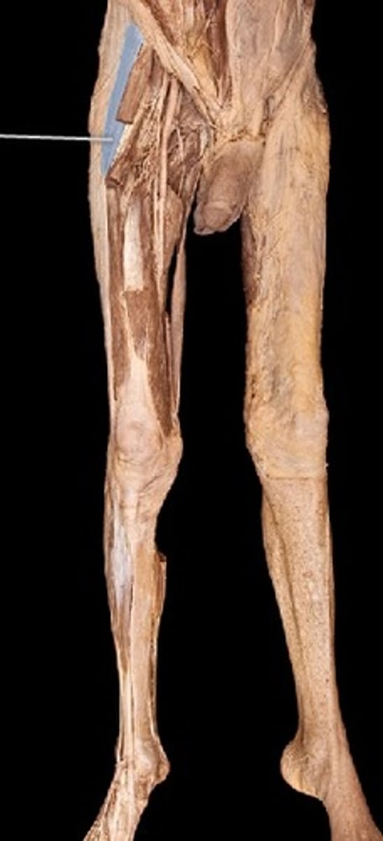 <p>What muscle is this?</p>