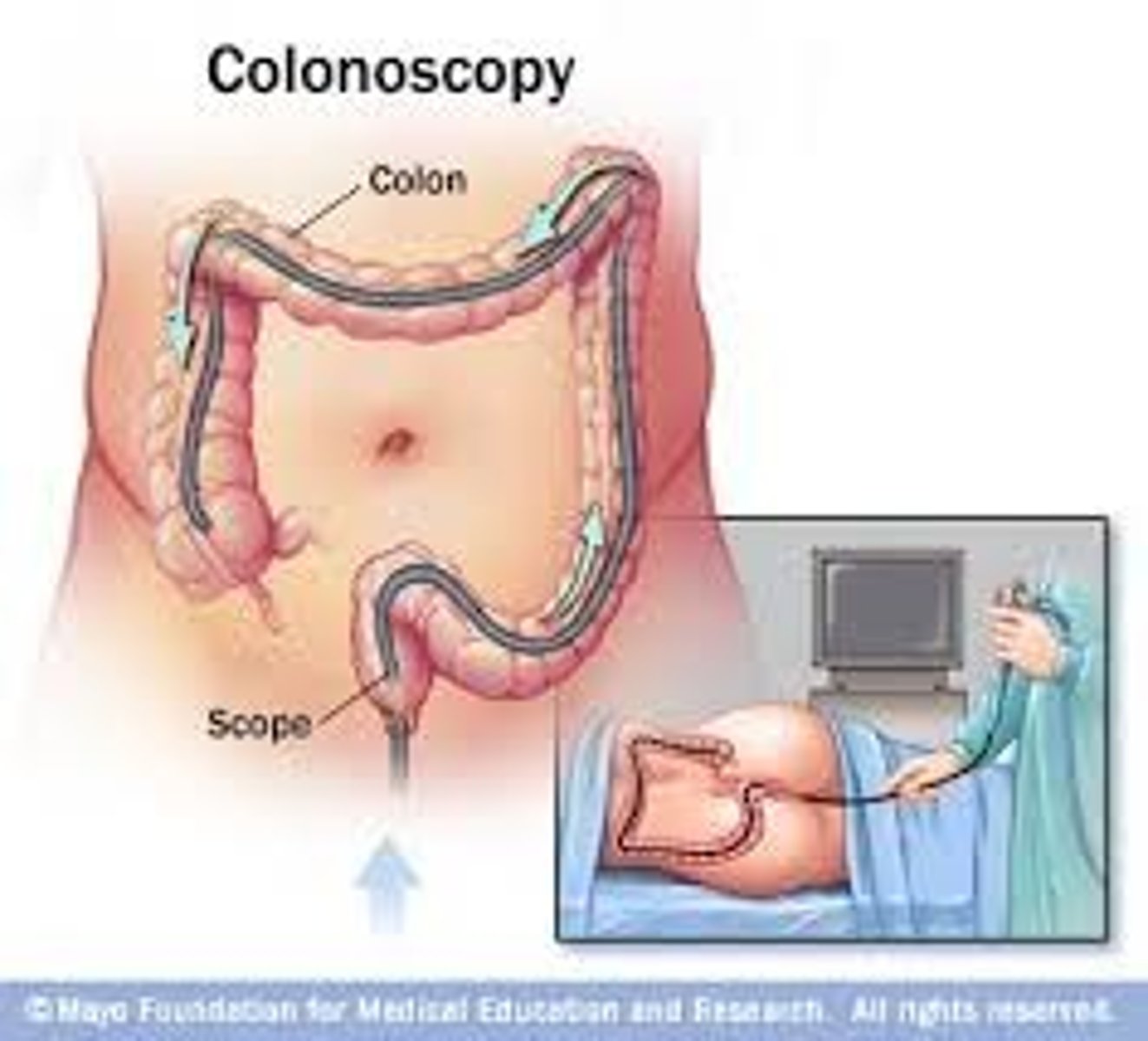 <p>A medical procedure which examines the inside of the colon.</p>