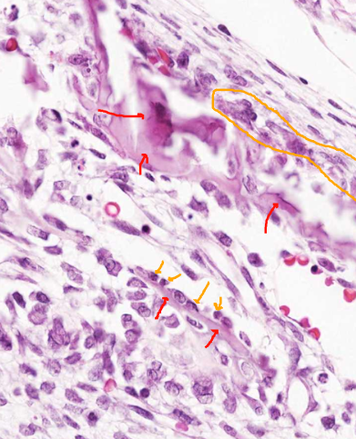 <p>Foetal head, coronal section, haematoxylin and eosin</p>