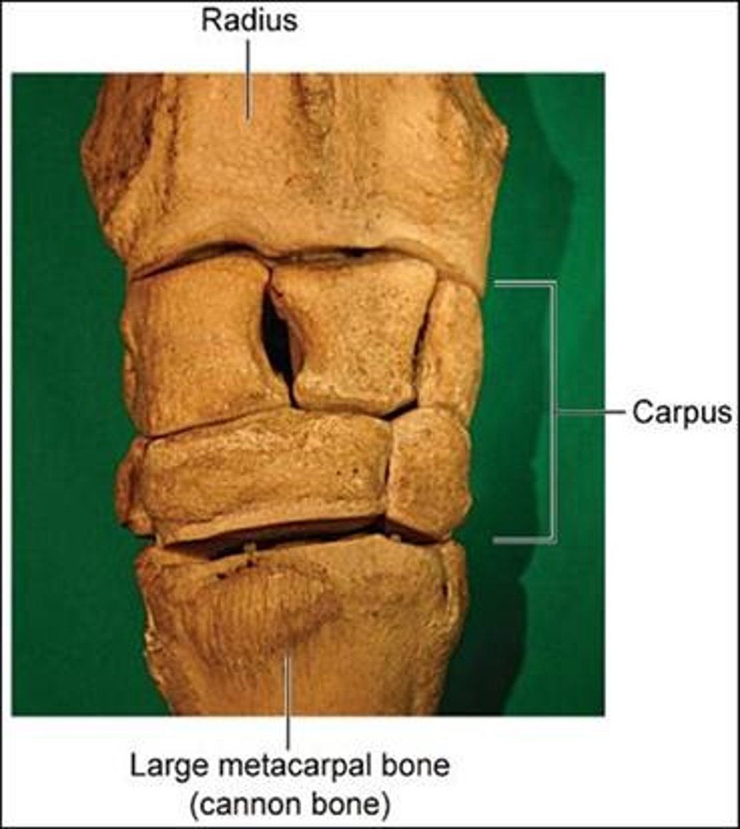 <p>Wrist joint, consisting of multiple small bones.</p>