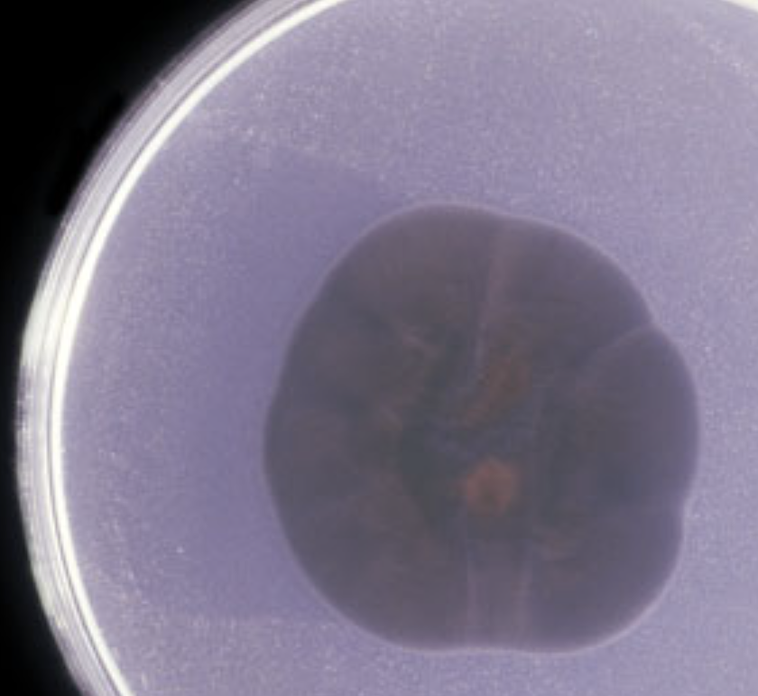 <p>What organism is this? Obverse or reverse?</p>