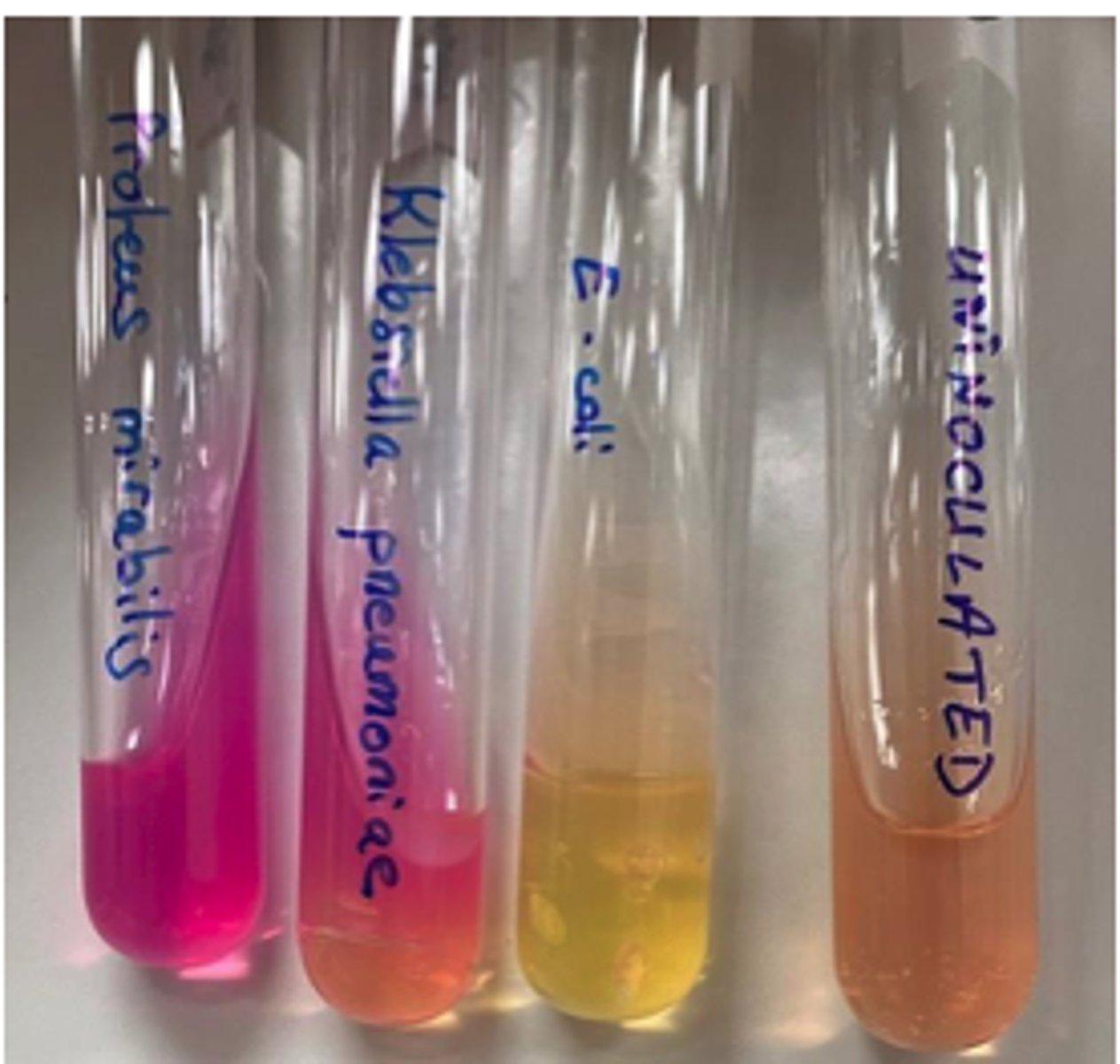 <p>Which of these bacteria are Urease positive</p>