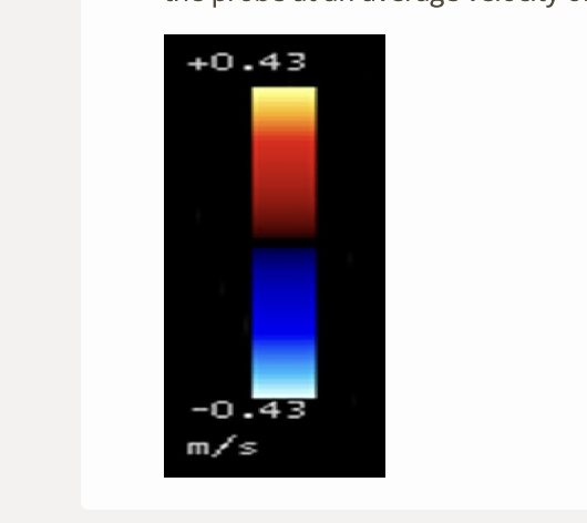 <p>what color will blood be shown moving toward the probe at an average velocity of <strong><u>100cm/s</u></strong></p><p>.</p><p>a) yellow</p><p>b) red</p><p>c) white/light blue</p><p>d) blue</p>