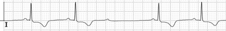 <p>What is the condition shown?</p>