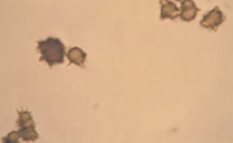 <ol start="72">
<li>What is ammonium Biurate?</li>
</ol>