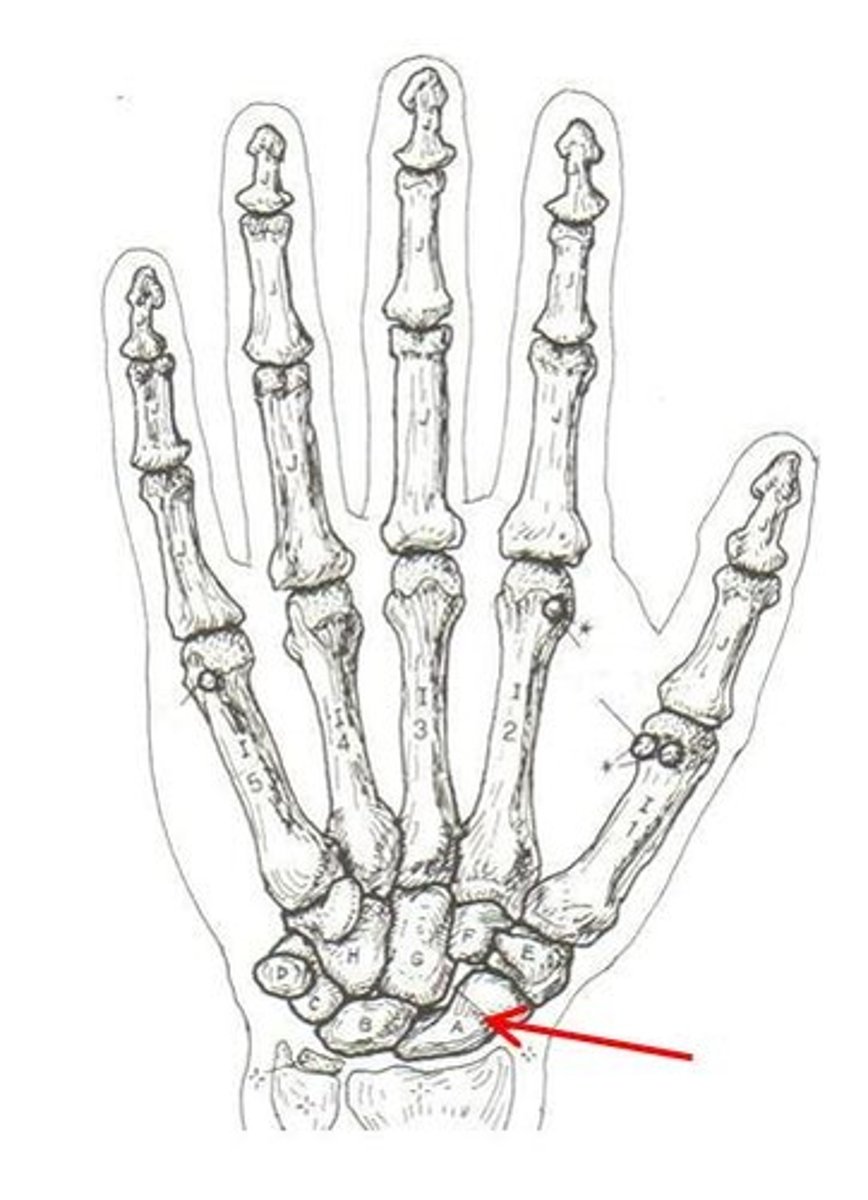 <p>ID bone</p>