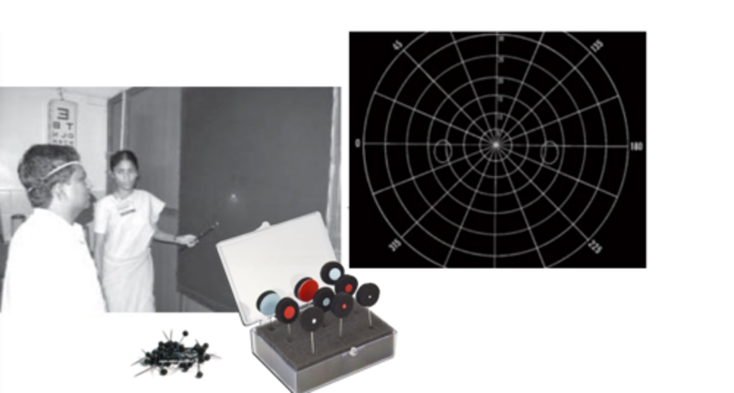 <p>a manual, kinetic visual field test that is performed monocularly with dim room lightly. A patient sits 1 meter away from a black felt screen and a pin is placed when they indicate a stimulus held up by the examiner is seen.</p>