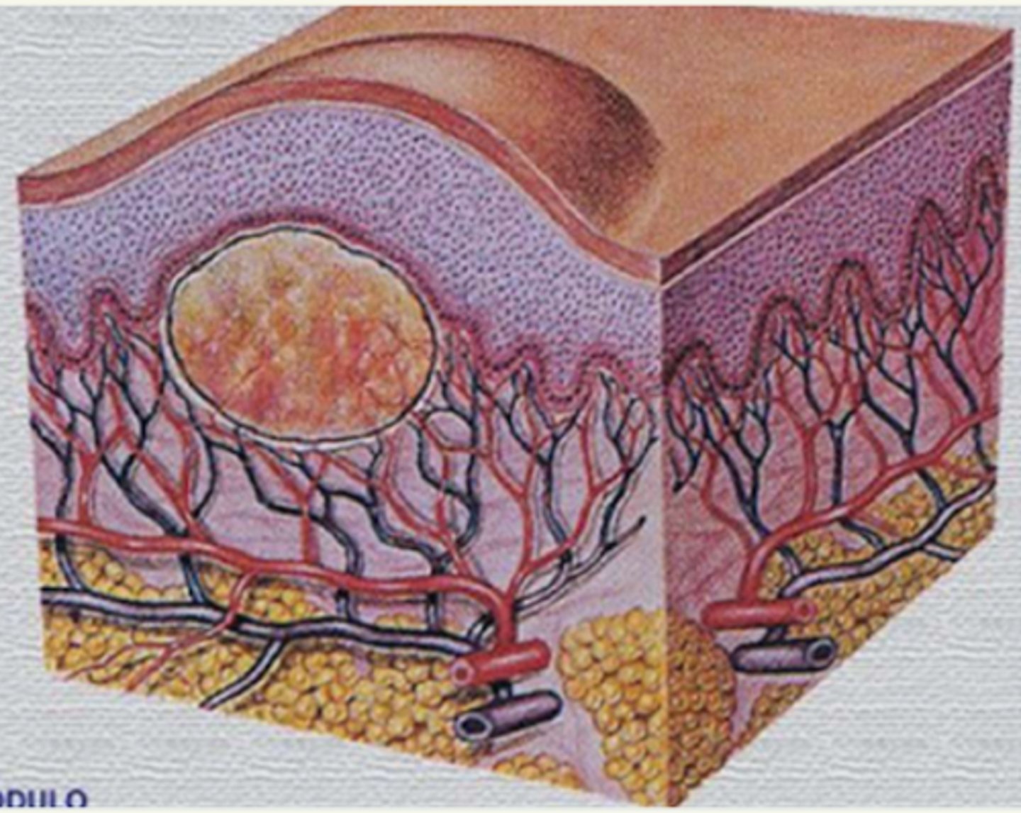 <p>¿lesión?</p><p>¿primaria o secundaria?</p>