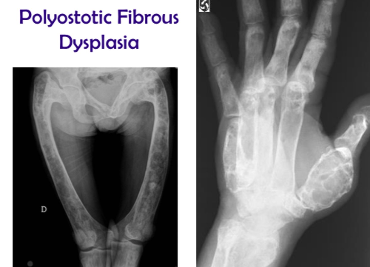 <p>Abnormality of development</p>