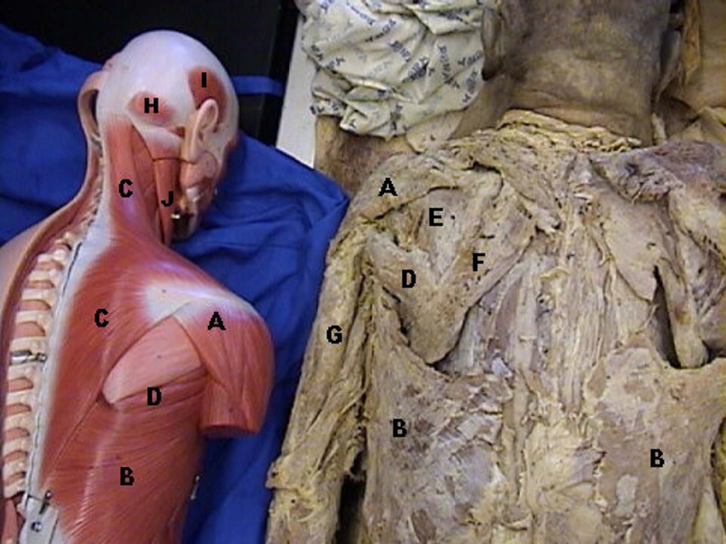 <p>E-, Laterally rotates shoulder; stabilizes the head of the humerus in glenoid cavity; Description: Partially covered by Deltoid and Trapezius, below supraspinatus on scapula, connects to humerus, Rotator Cuff</p>