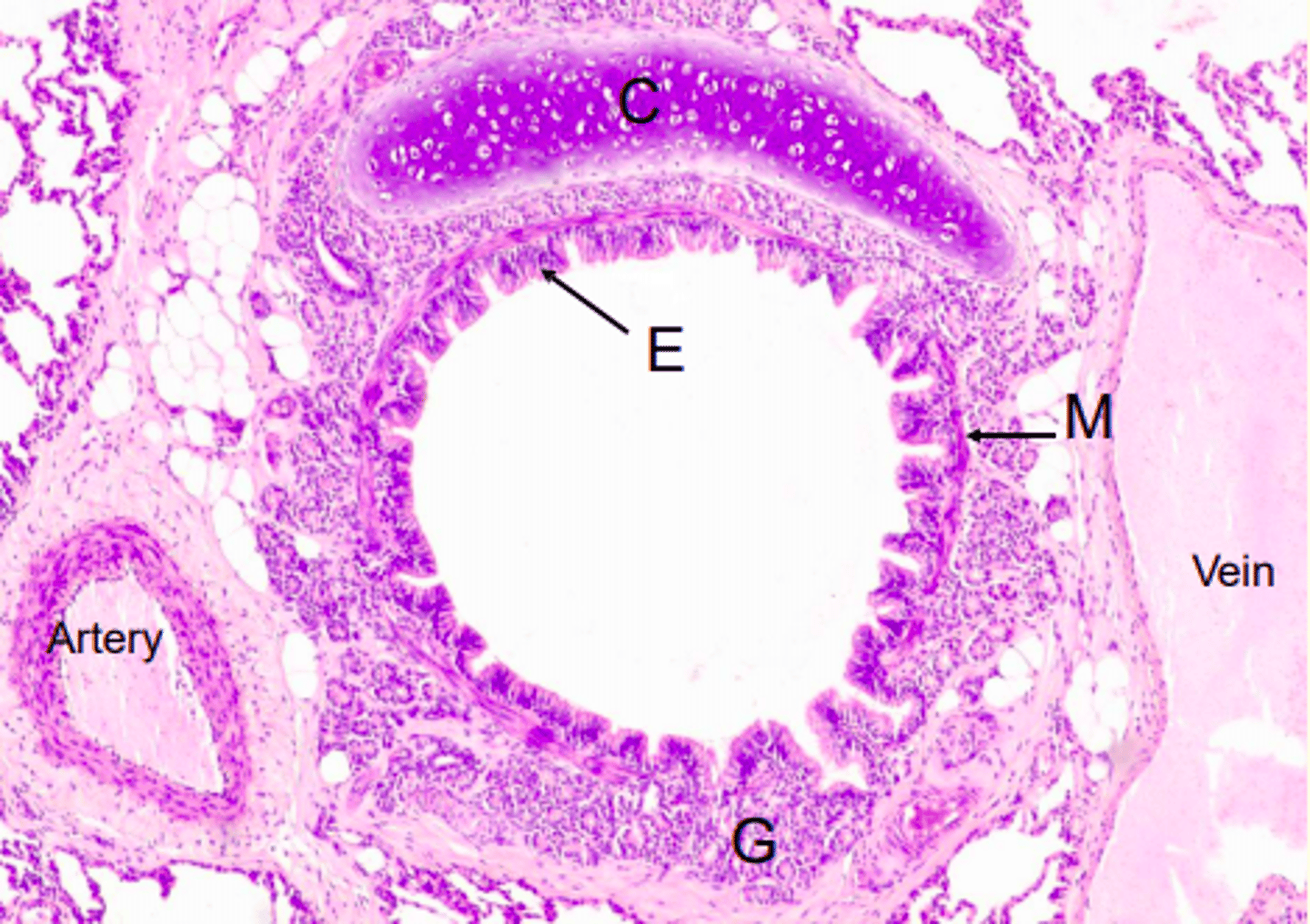 <p>A bronchus</p>