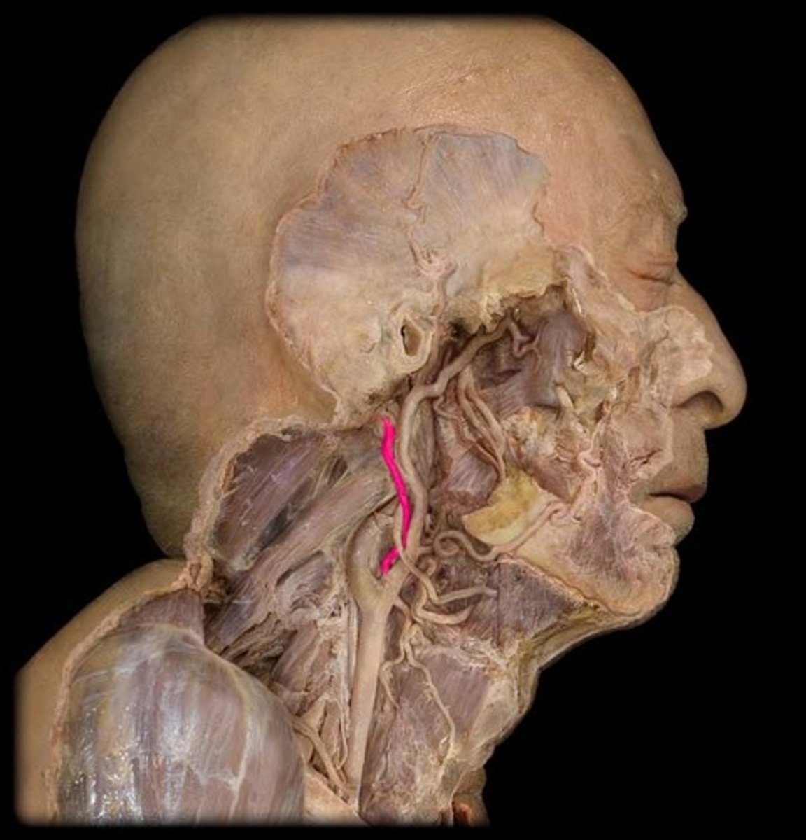 <p>Branch of the external carotid artery that supplies blood to the skin and muscles of the scalp and back of the head up to the crown.</p>