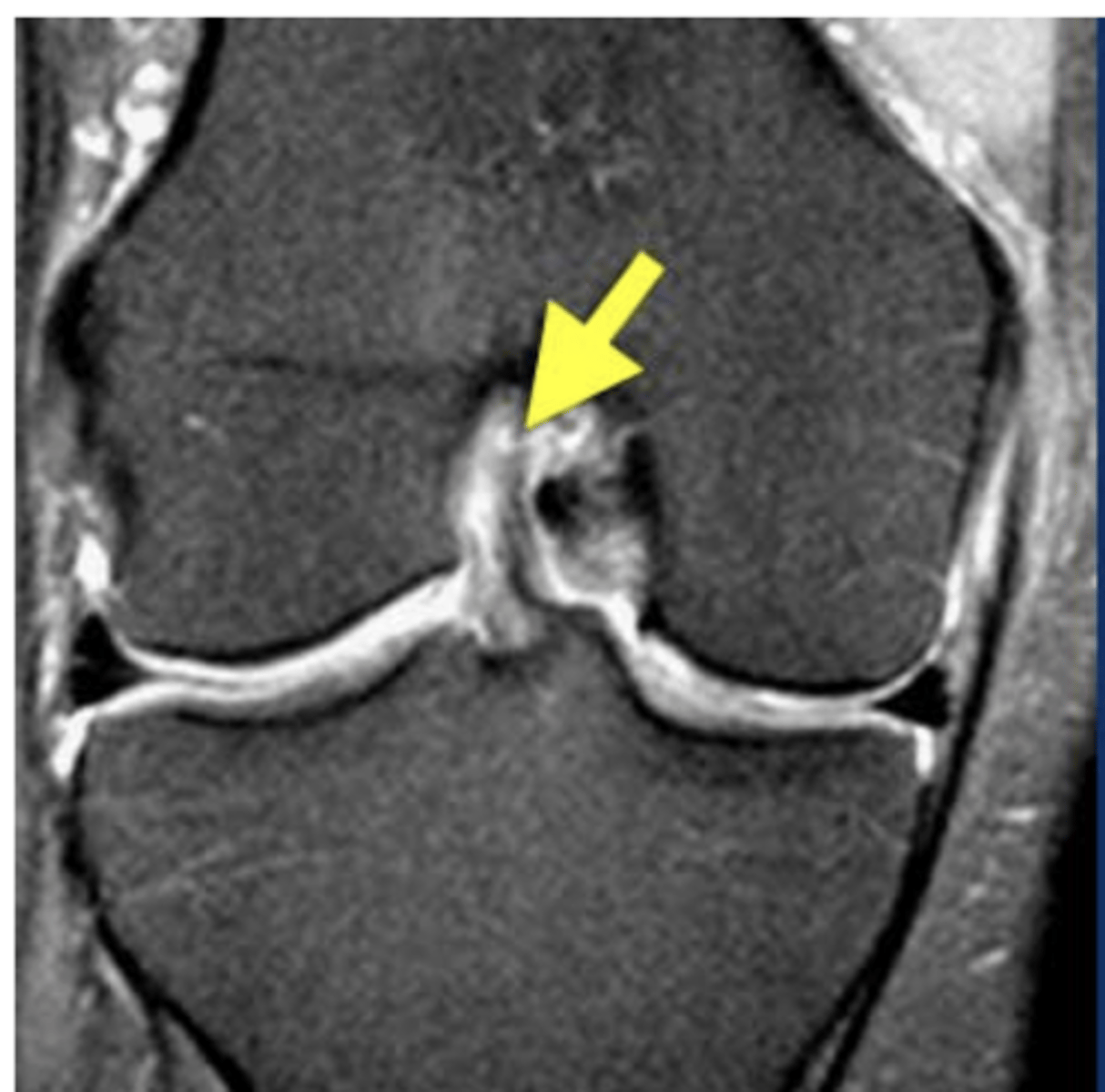 <p>Define the pathology.</p>