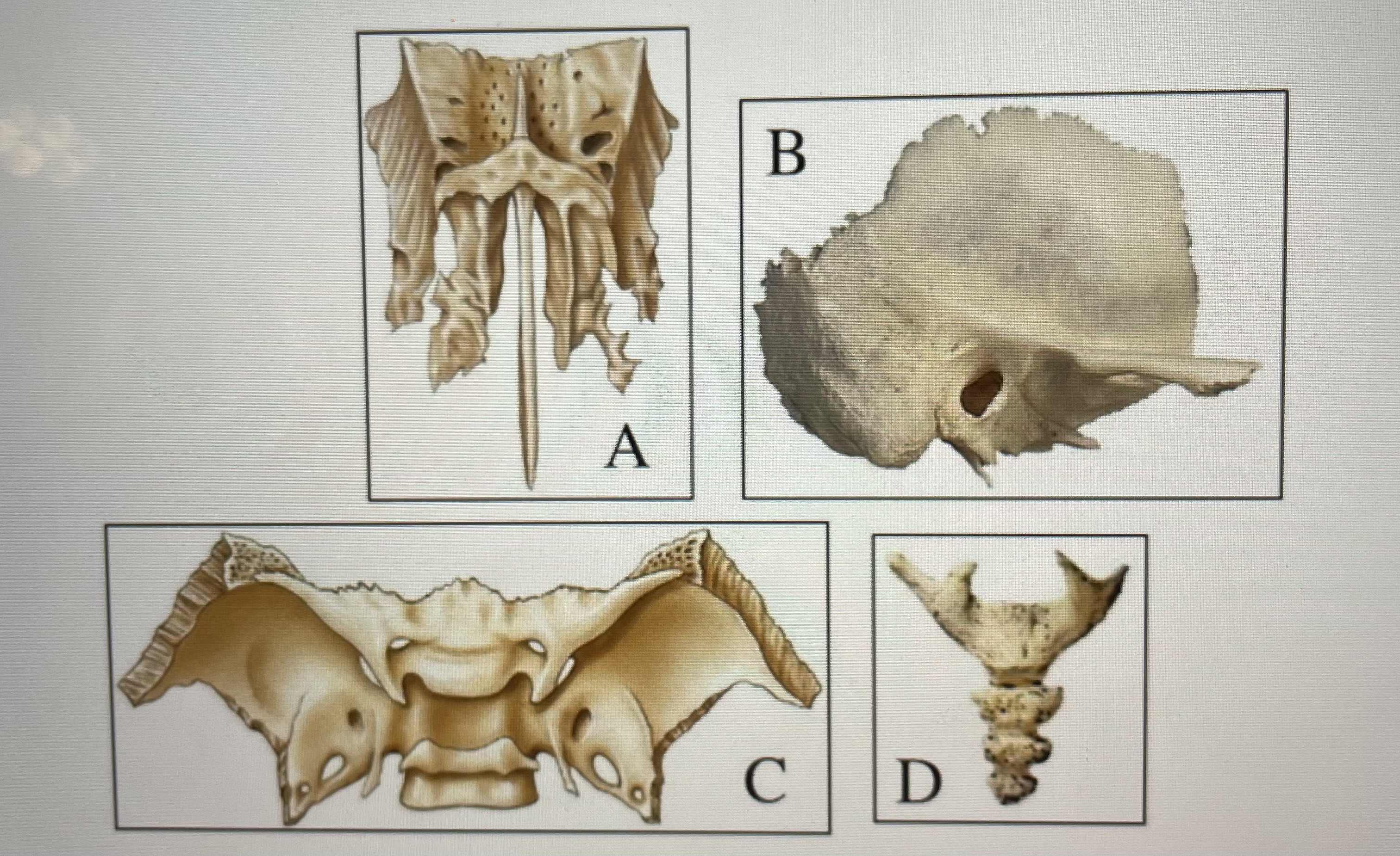 Based on the figure above identify each bone 