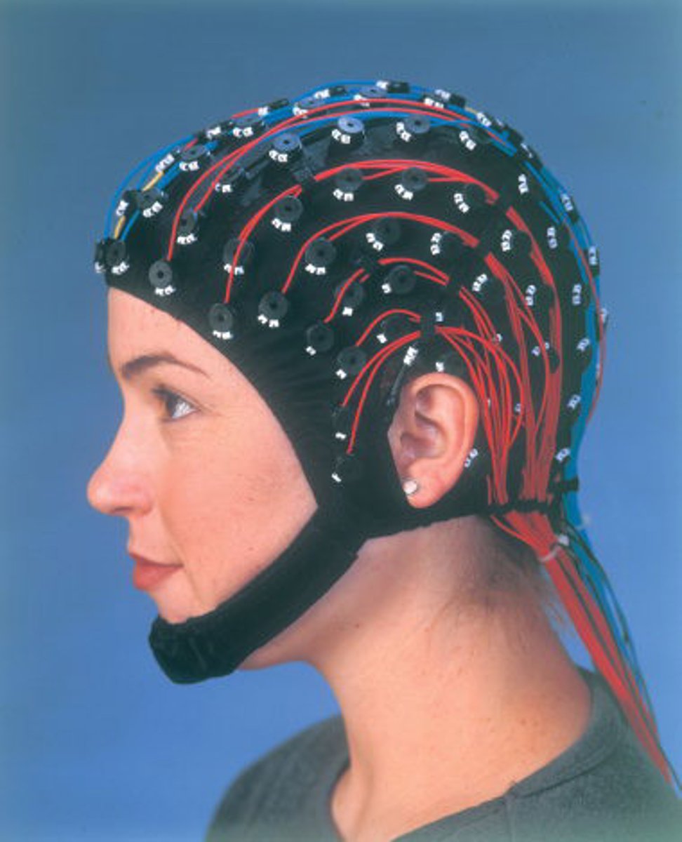 <p>recording of the brain's electrical activity at the</p><p>surface of the skull</p>