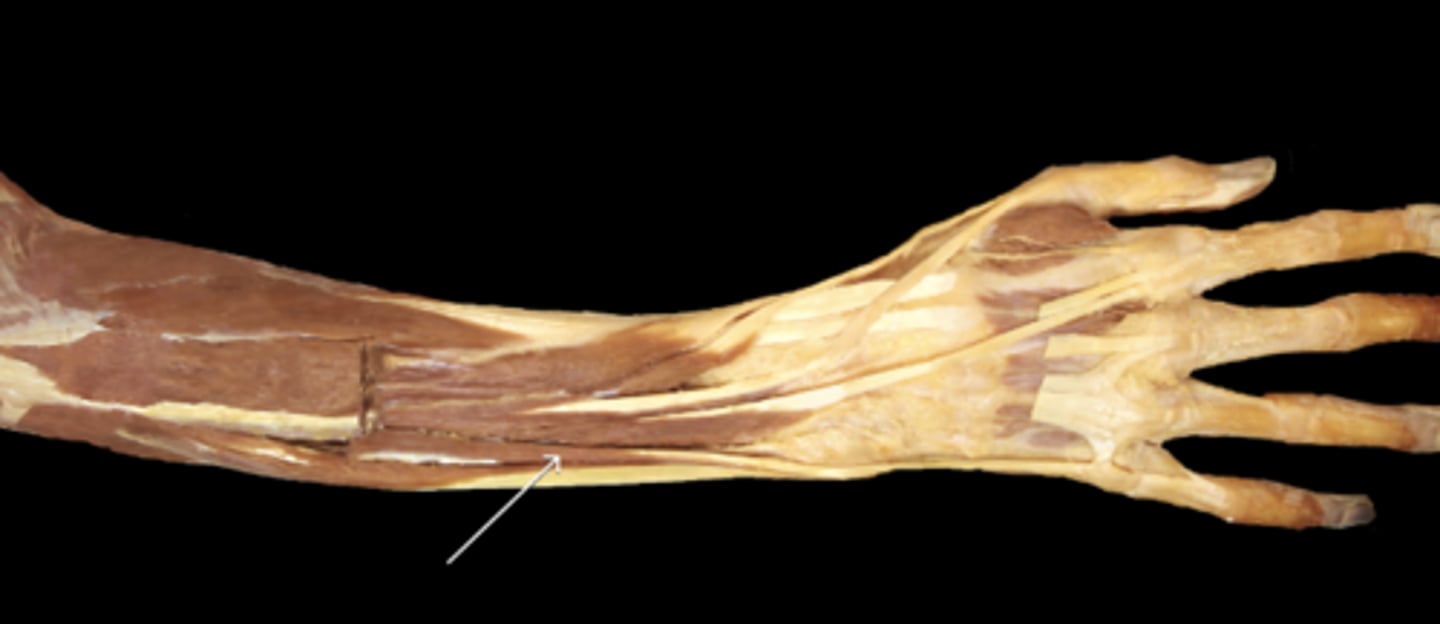 <p>Extensor digitorum cut away</p>