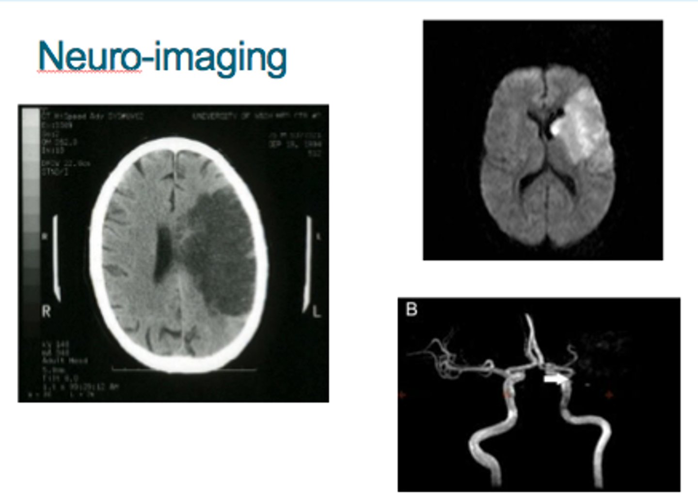 <p>- the use of various techniques to provide pictures of the structure and function of the living brain</p><p>- neuroimaging is an indirect measure</p><p>- has good spatial resolution and bad temporal resolution</p>