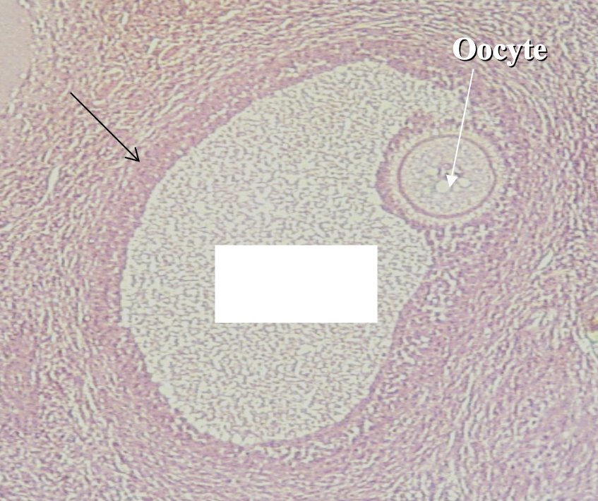 <p>What are the structures indicated by the black arrow?</p>