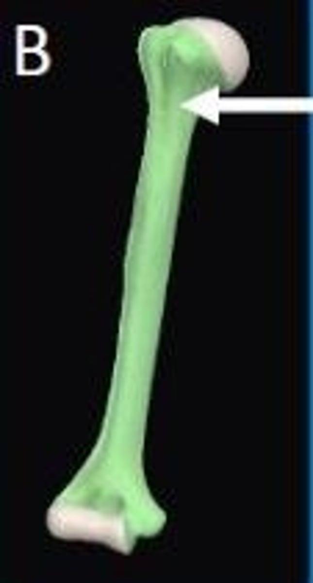 <p>Epiphyseal plate</p>