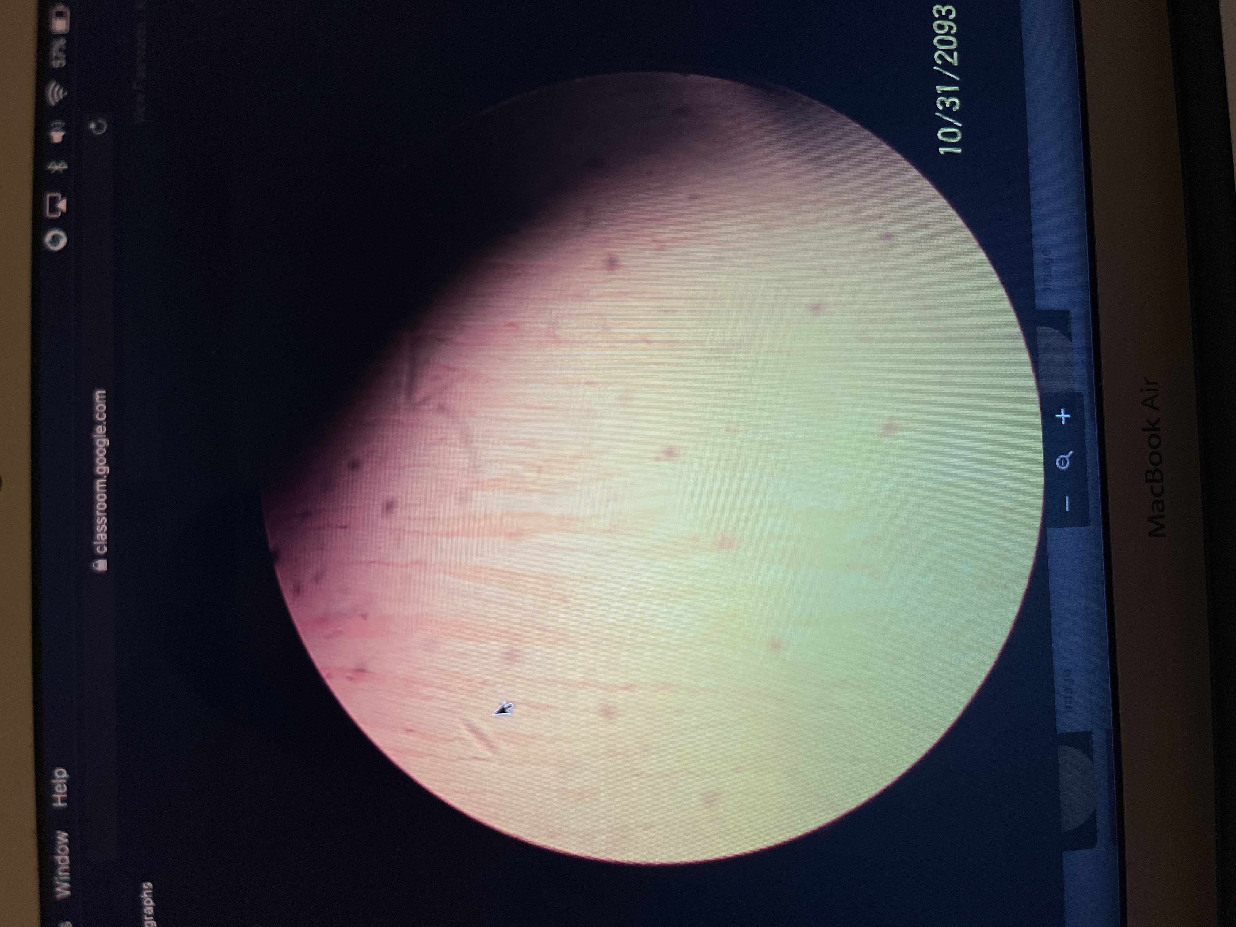 Location: tendons
Function: provides strong attachment between various structures