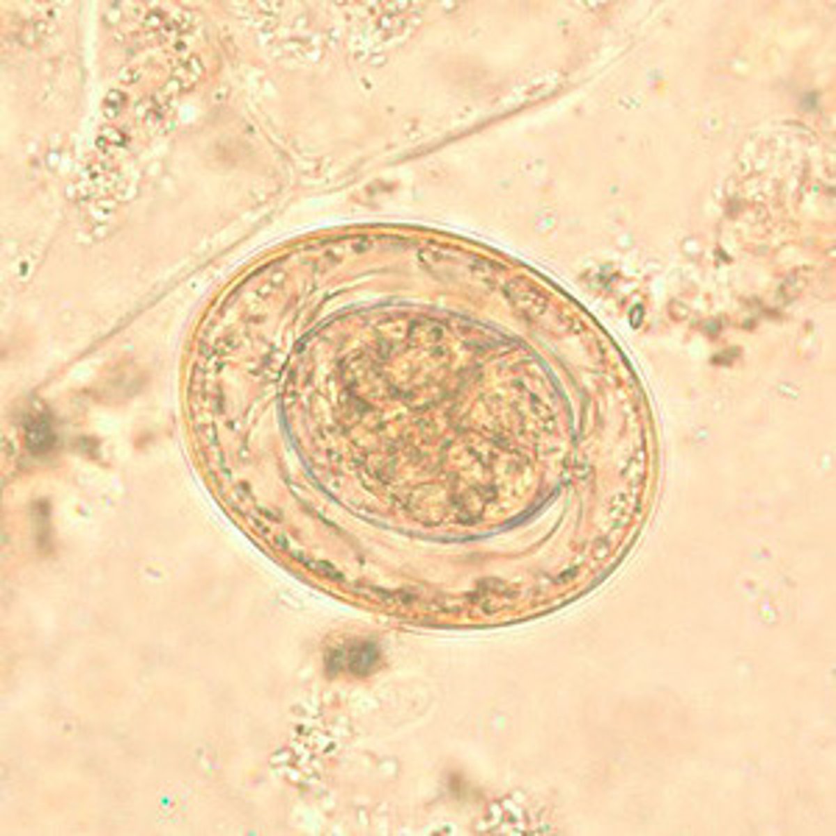 <p>Polar filaments coming off center embryo into dirty space of the outer shell</p><p>6 hooklets on embryo (hexacanth)</p>
