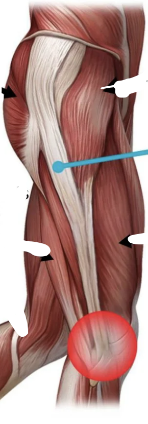<p>Long thick tissue <span><span>running along the outside of your thigh from your hip to your knee</span></span></p>